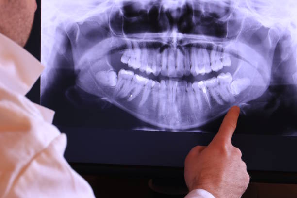 Best Walk-In Emergency Dentist in Normandy Park, WA