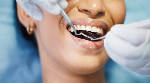Best Emergency Root Canal Treatment in Normandy Park, WA